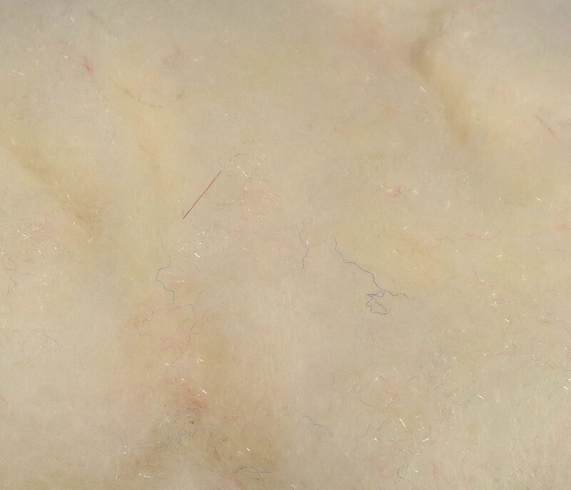 UV2 Fine and Dry Dub